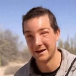 Bear Grylls Bee Sting