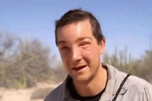 Bear Grylls Bee Sting