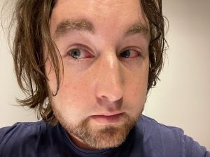 Ben's eyes